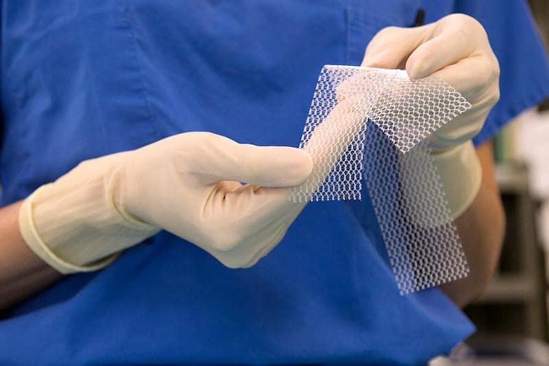 Вагинальная сетка имплантант mesh